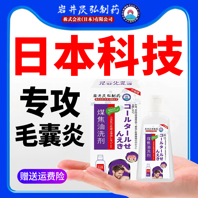 岩井昃弘制药煤焦油洗剂洗发水脂溢性皮炎去屑止痒官方旗舰店正品