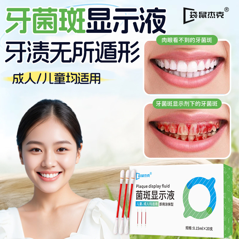 【牙医推荐】菌斑显示剂去牙菌斑