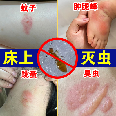 灭咬人虫臭虫跳蚤药杀虫烟剂家用