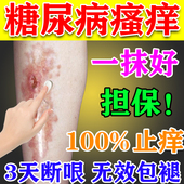 糖尿病皮肤痒专用治老年人高血糖皮肤痒瘙痒药全身干燥脱皮止痒膏