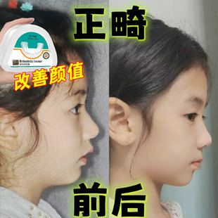 儿童牙齿矫正器纠正门牙前突龅牙口呼吸深覆合地包天凸肌功能牙套