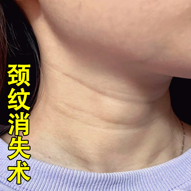 7天告别颈纹】去颈纹神器 屈臣氏热销别让暴露你的年龄~远离颈纹~