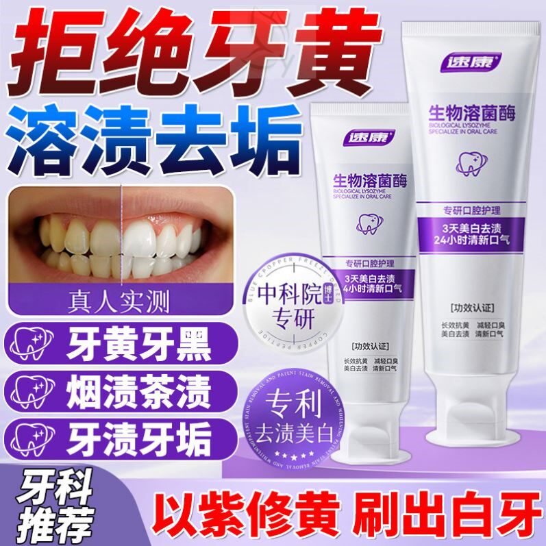 牙膏排行榜第一名美白去黄去口臭去牙渍牙垢黄牙清新口气美白牙膏