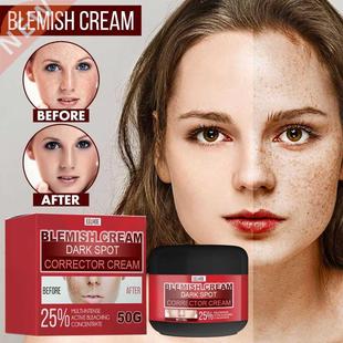 Whitening Freckle Cream Remove Melasma Acne Spot Pigment