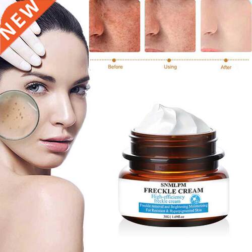 SNMLPM Whitening Freckle Cream Chinese Herbal Plant Face