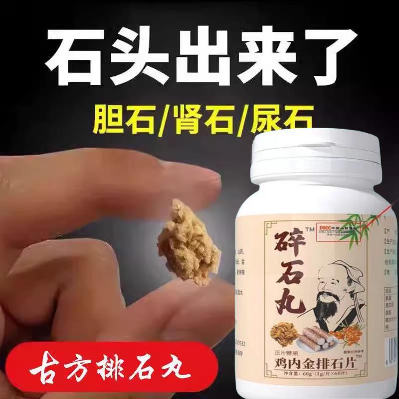 鸡内金碎石丸化石溶石洁石去输尿管胆囊膀胱结肾石