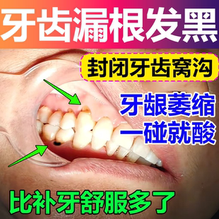 牙齿根外露发黑漏根楔状缺损敏感牙龈萎缩冷热敏感牙齿周炎wg