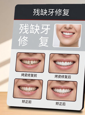 残缺牙修复 口腔门店项目宣传 桌面摆件