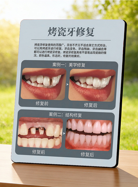 烤瓷牙修复 口腔门店项目宣传 桌面摆件