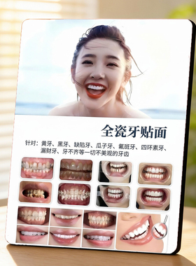全瓷牙贴面 美业门店项目宣传 桌面摆件