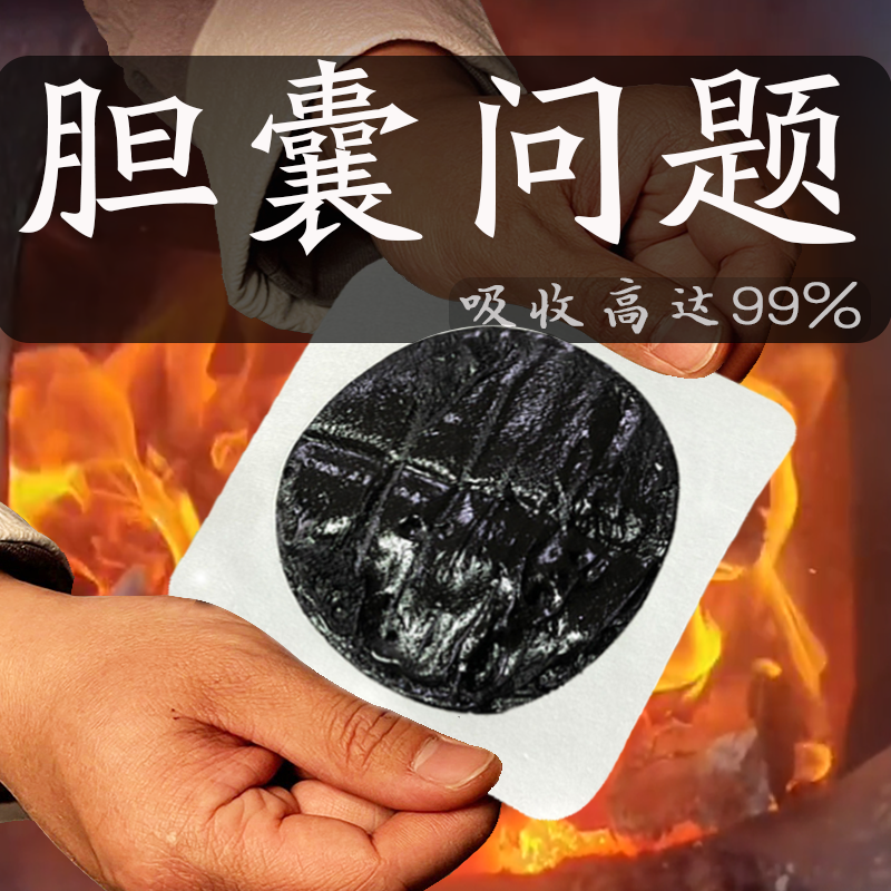 老医熬制消除胆囊息肉特效多发炎胆囊息肉中药胆结石溶石化中药贴