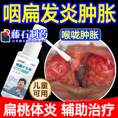 扁桃导条体发炎除咳嗽根喷剂