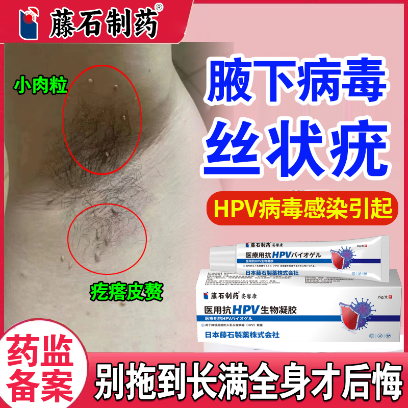 【药监备案】腋下丝状疣抗HPV