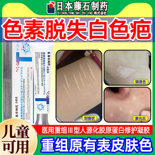 去皮肤色黑素沉淀儿童白色疤痕色素脱失增生凸起去除疙瘩止痒膏xj