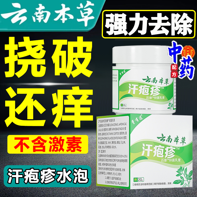 【汗疱疹】中草药止痒汗疱疹药膏