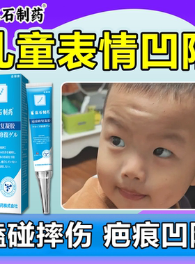 儿童表情凹陷性疤痕生长修除膏因子复专摔伤小孩额头用白色水痘wg