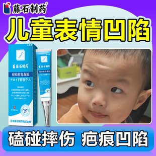 儿童表情凹陷性疤痕生长修除膏因子复专摔伤小孩额头用白色水痘wg