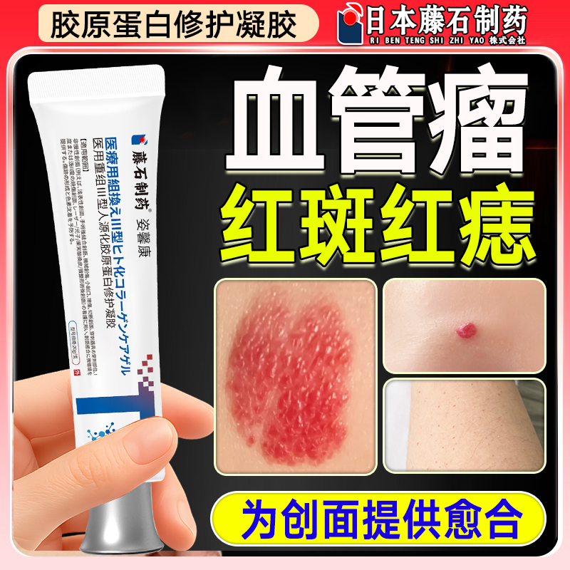 樱桃状血管瘤血管红痣凝胶专搭用蜘蛛痣去除凝胶药监备案软膏hy