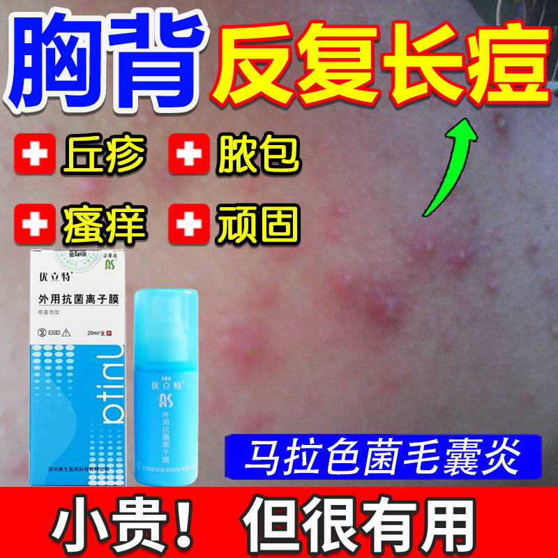 【药监备案】前胸后背反复毛囊炎