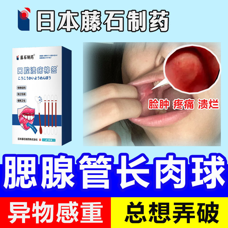 腮腺炎导管口长肉球一点灵口腔溃疡脸部内壁囊肿疼痛医用棉签棒mf