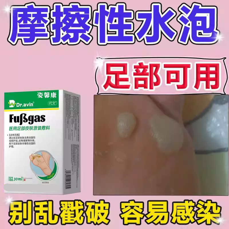 脚底摩擦起去水泡湿止痒专脚气脱皮杀菌疹臭真菌感染用出汗喷剂wg