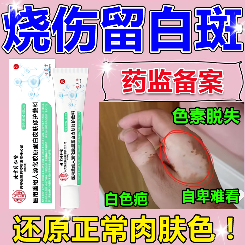 烧伤后留白色斑色素脱失医用除疤