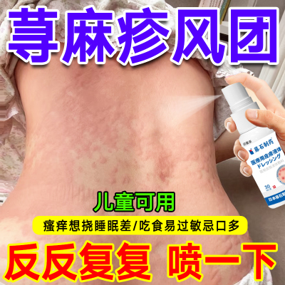 丘疹慢性进儿童口荨麻疹过敏风团止痒喷剂提高止痒断免疫力根hy