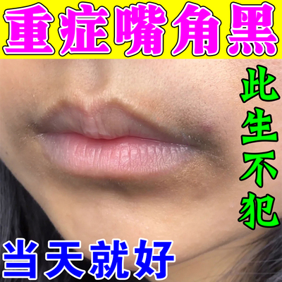 嘴角发黑改善唇周黑淡化暗沉去除嘴巴周边黑色素沉淀死皮专用唇膏
