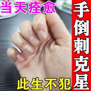 手指长倒刺营养油防手上起倒刺肉刺去指甲边缘脱死皮干裂修复神器