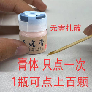 点痣药水膏去痣点痣美容院专用不留疤无痕祛黑痣去痦子斑点刺正品