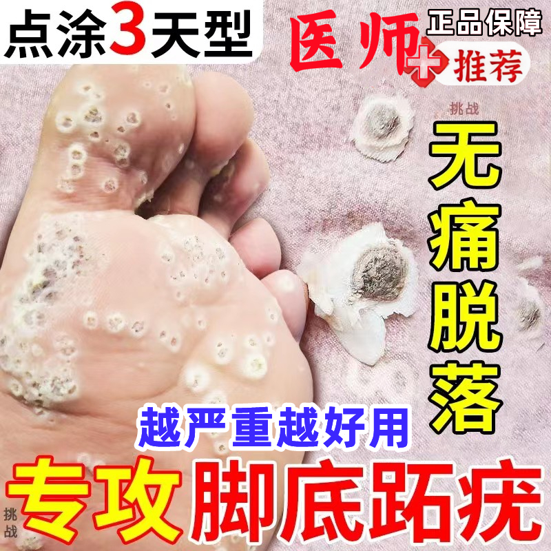 治愈100w跖疣患者效果好不反覆