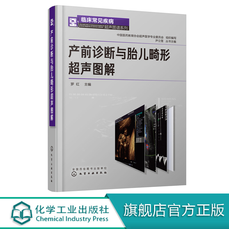 产前诊断与胎儿畸形超声图解 胎儿畸形产前超声诊断学书籍 临床妇科常见疾病诊断治疗医学书籍 妇科书 临床常见疾病超声图谱系列