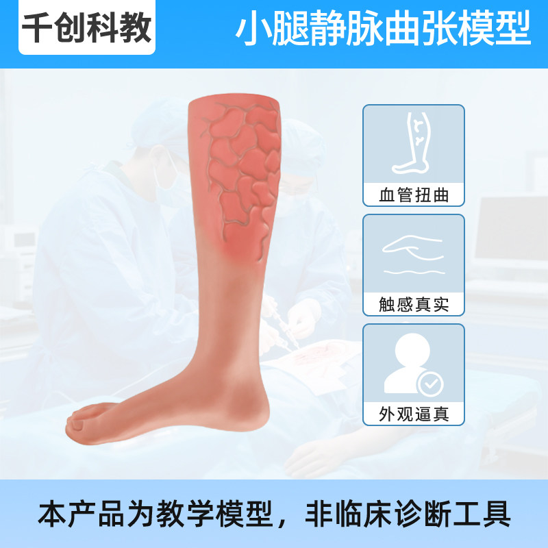 静脉曲张模型小腿足部解剖教具 硬质PVC医用教学模型 体征识别考试用 医学院护理培训教具零耗材低成本