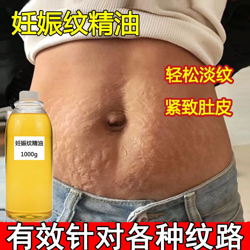 妊娠纹修复精油紧致淡纹祛肥胖纹孕妈预防产后纹淡化妊娠纹修护膏