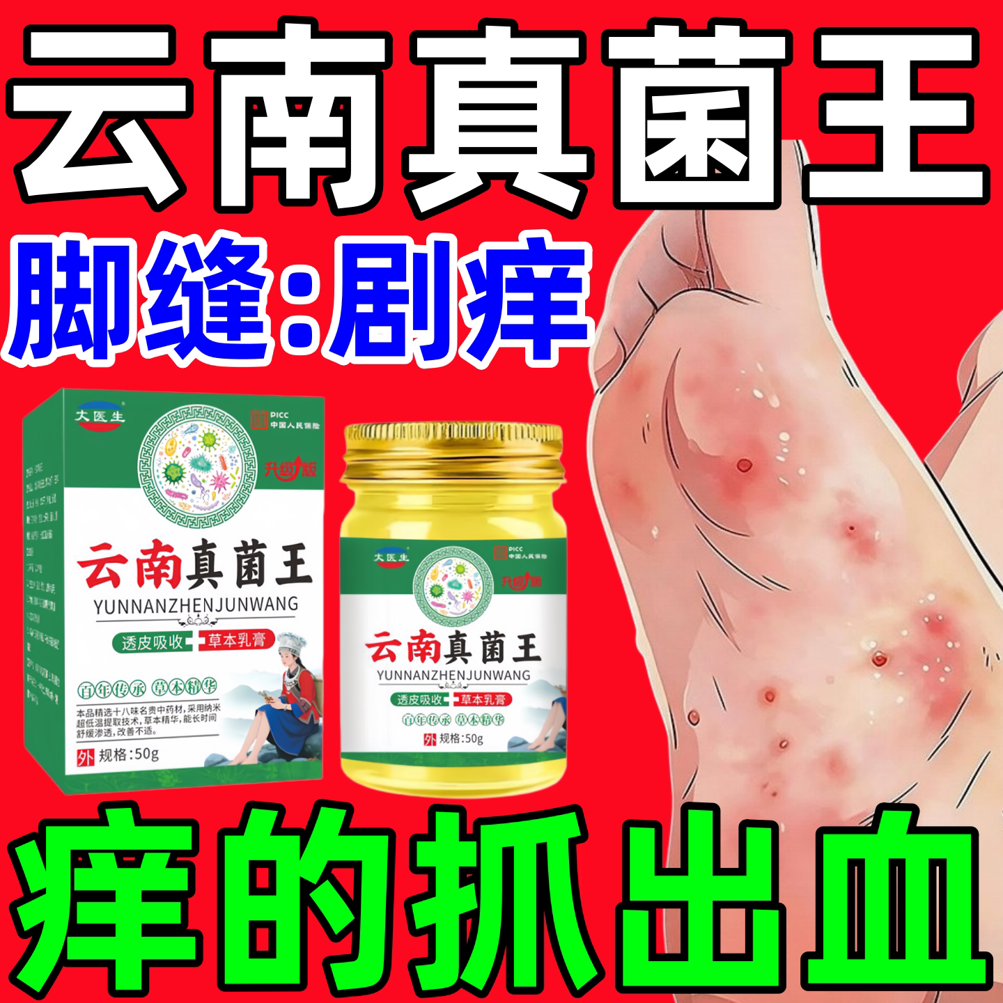 云南真菌王脚气烂脚丫药脱皮糜烂脚趾脱皮杀菌真菌感染正品乳膏
