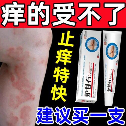 炉甘石抑菌止痒软膏外用疹湿外用顽固皮炎皮肤瘙痒婴儿抑菌专用膏