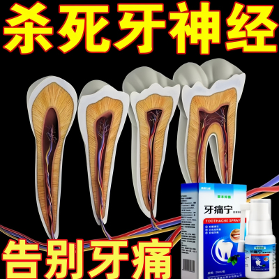 牙痛宁喷雾剂药智齿上火抗菌杀神经牙疼牙龈肿蛀牙蛀虫止护理专用