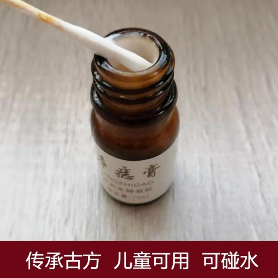 候子祛除神器点痣药水无痕正品祛痣膏斑学生黑痣脸部除痣取痣