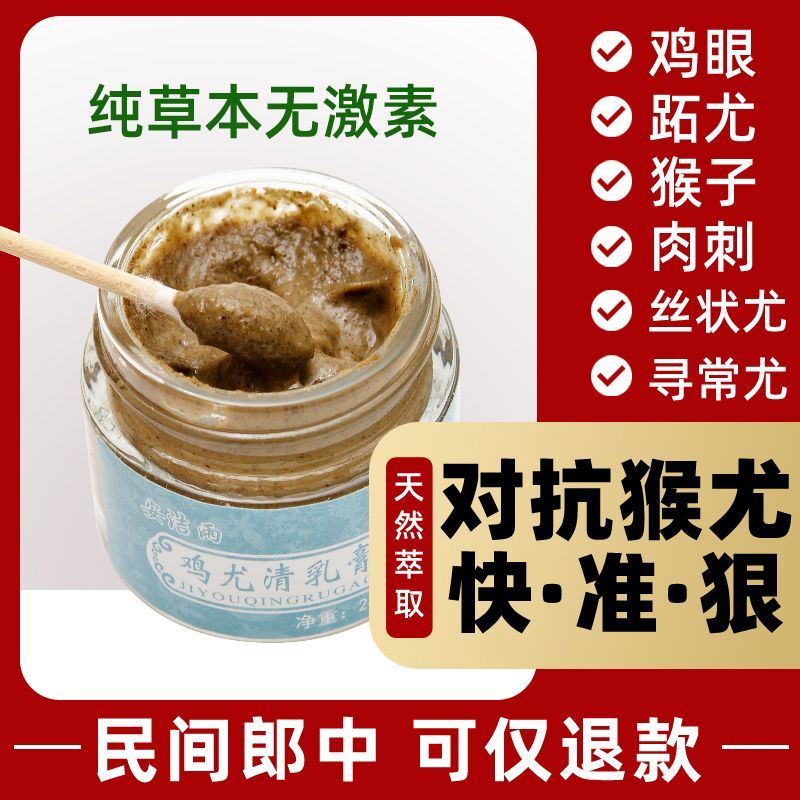 瘊子祛除神器去除鸡眼小肉粒寻常刺猴子肉刺猴子膏病毒拓灵特效膏