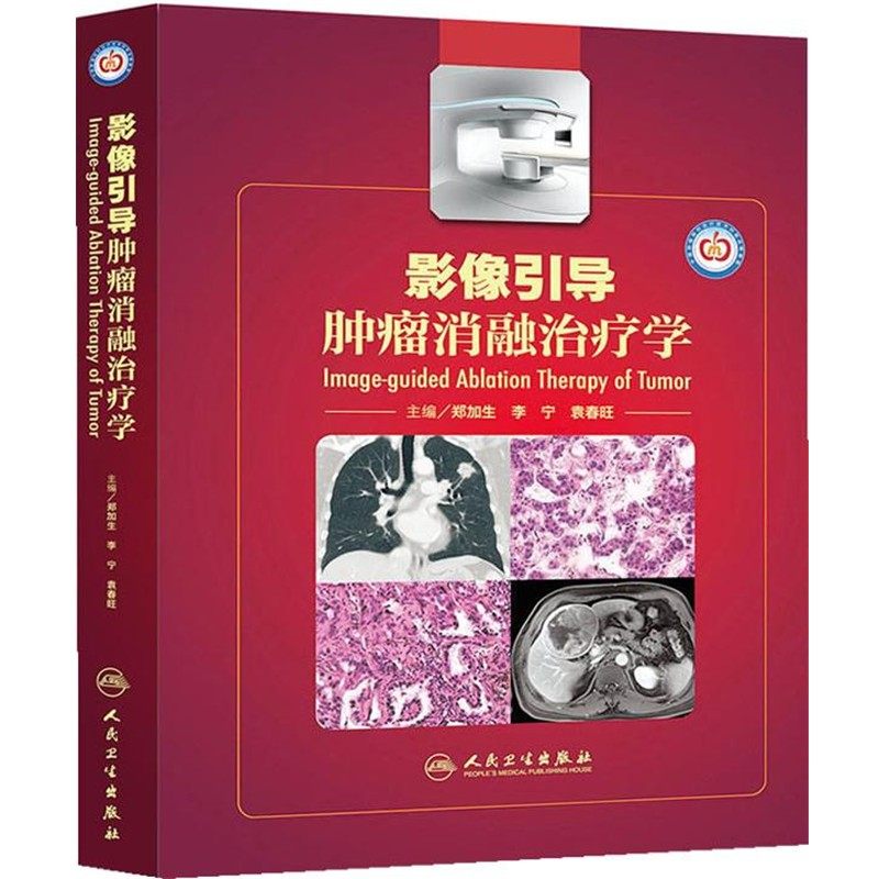 正版包邮影像引导肿瘤消融治疗学郑加生,李宁,袁春旺 主编人民卫生出版社9787117179591