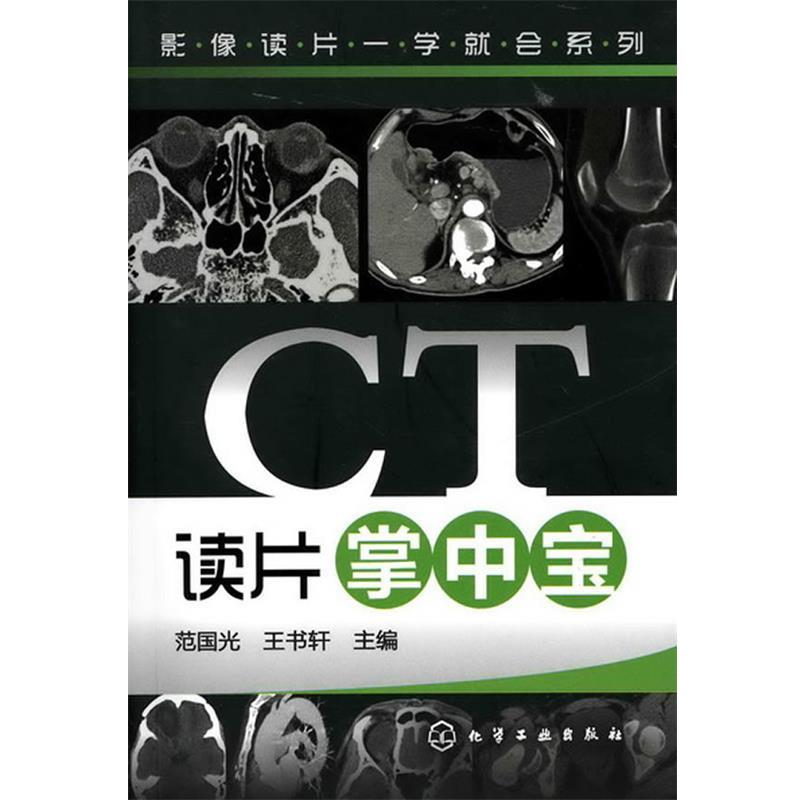 【正版书籍】 影像读片一学就会系列--CT读片掌中宝 范国光 化学工业出版社