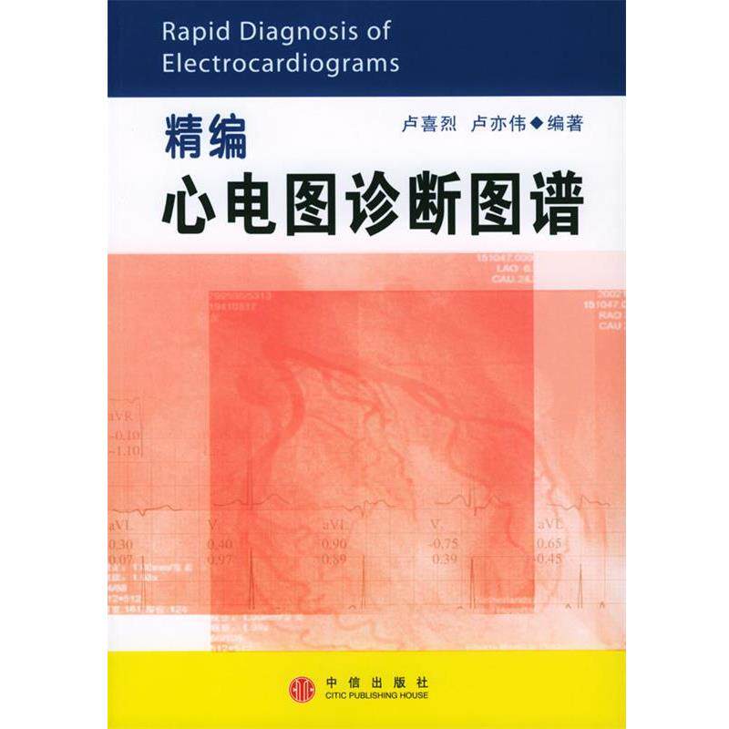 【正版书籍】 精编心电图诊断图谱 卢喜烈,卢亦伟 编著 中信出版社