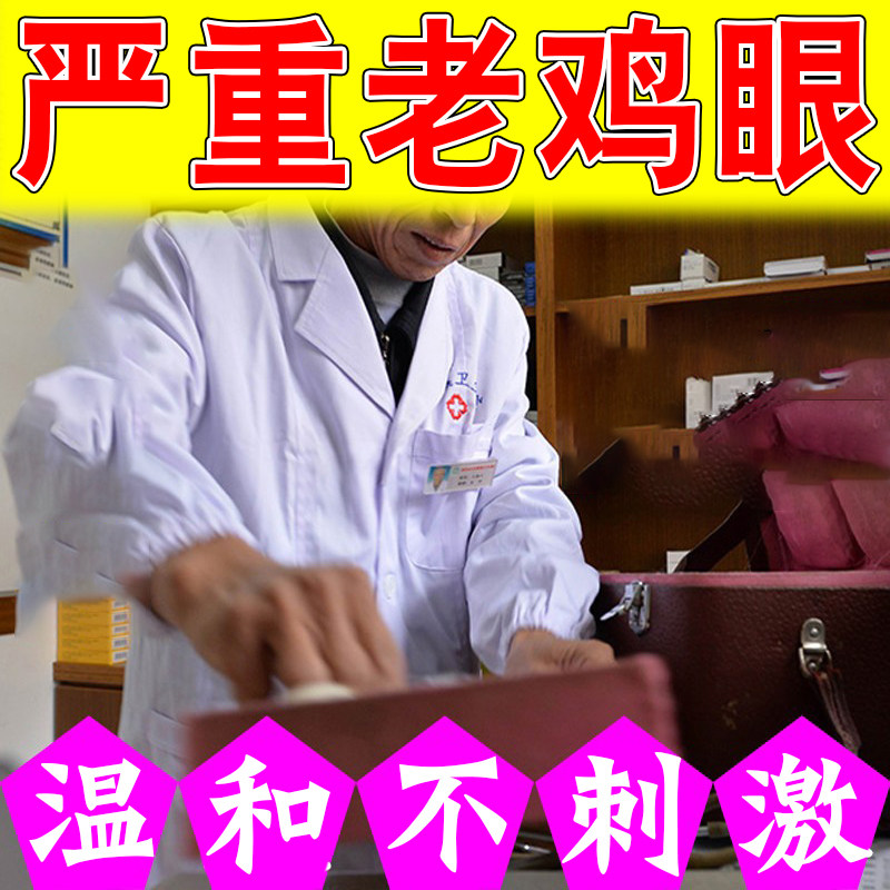 脚底手指长肉粒肉刺跖脚垫老茧脚底足部手上起硬皮疙瘩老茧外用贴,洗护清洁剂/卫生巾/纸/香薰,足贴,淘宝优惠券,粉丝福利购,淘宝优惠卷