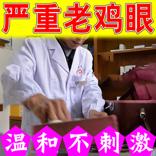 脚底手指长肉粒肉刺跖脚垫老茧脚底足部手上起硬皮疙瘩老茧外用贴