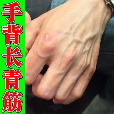 手部血管凸起手背青筋凸起静脉青筋凸起软膏