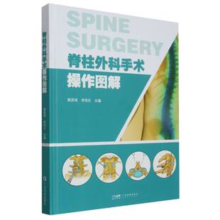 责编 黎青青 医学卫生 高梁斌 外科学 报纸 李危石 杂志 脊柱外科手术操作图解编者 方敏9787535979568广东科技书籍
