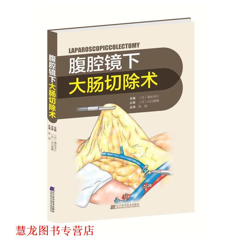 【正版书籍】 腹腔镜下大肠切除术 (日)福长洋介 辽宁科学技术出版社