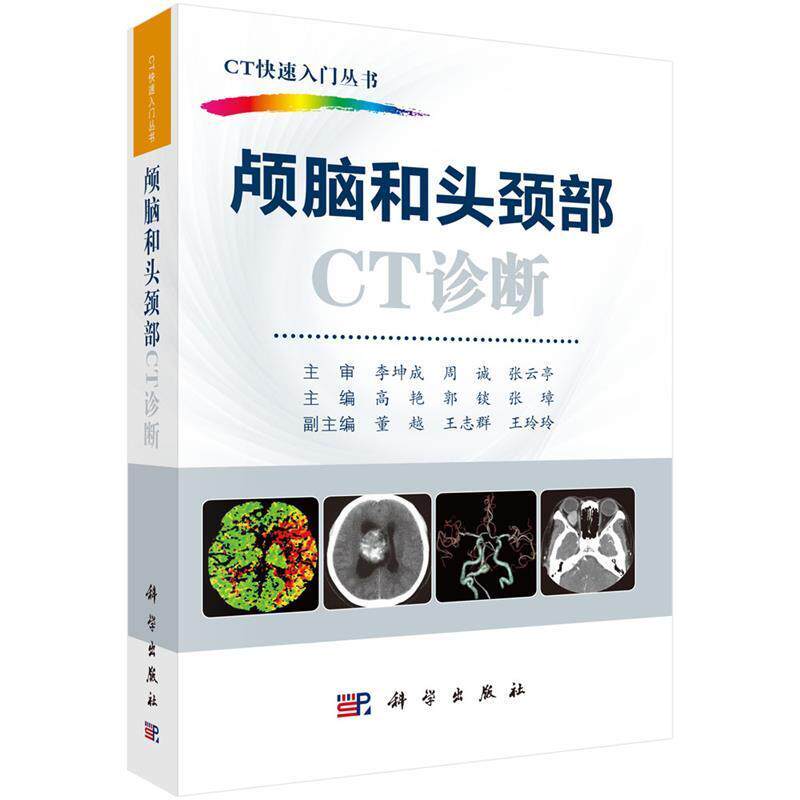【正版书籍】 颅脑和头颈部CT诊断 高艳,郭锬,张璋 科学出版社