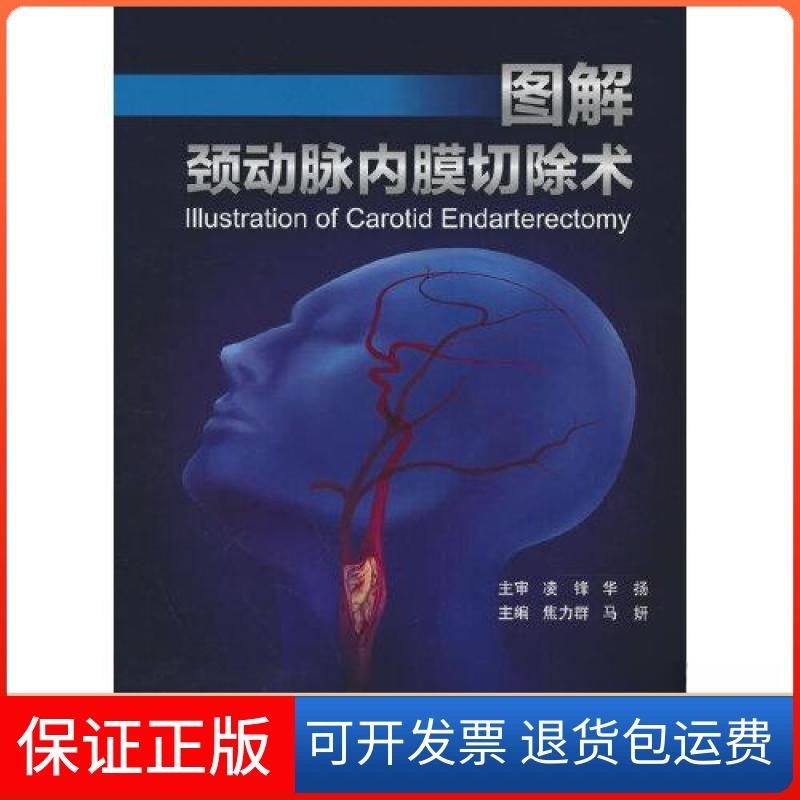 【保正版】图解颈动脉内膜切除术焦力群;马妍北京大学医学出版社9787565927652