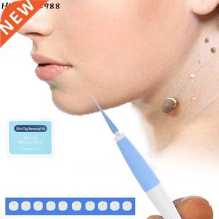 Skin Tag Remover To Remover Wart Spot Remover Mole Remover S